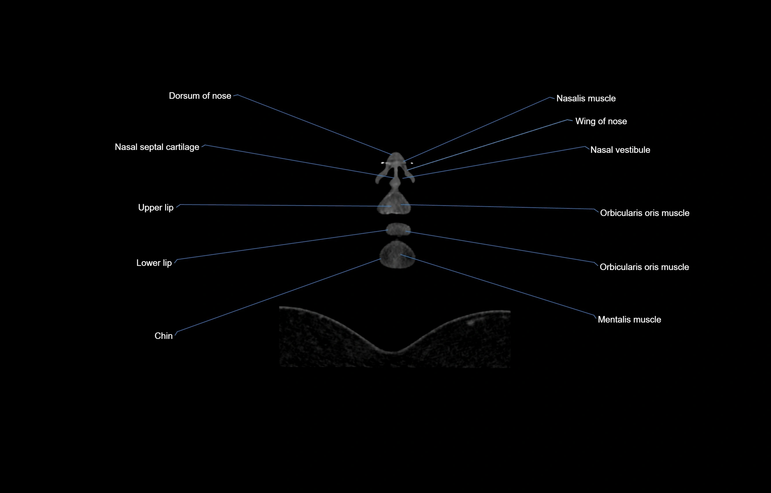 CT Neck coronal  cross sectional anatomy labelled 3D  radiology  image-00004.webp